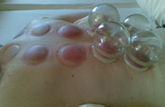 Bodywork-cupping